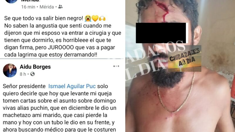 Le rompió la cabeza con un tubo, el año pasado el mismo sujeto le dio un machetazo.
