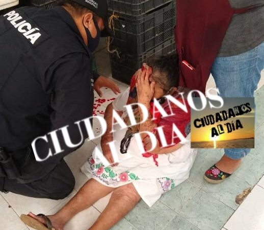 Alcalde pone en riesgo la vida de los motuleños, una abuelita resultó con la cabeza rota.