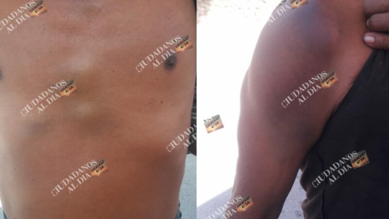 Policías de Dzidzantún confunden a un albañil con un borracho, lo estropearon y después le dan la libre