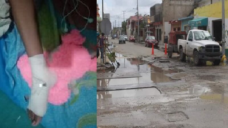 Un niño se va en un bache y se fractura el pie en Progreso