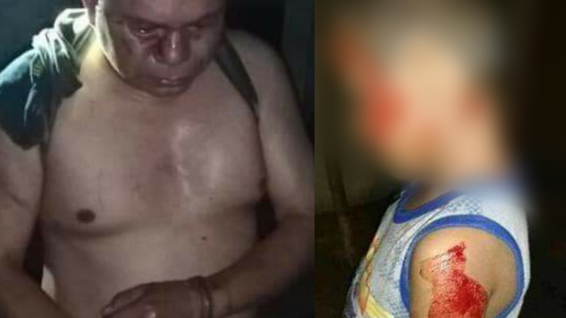 Inhumano padre intento matar a sus hijos, vecinos de Chontalpa los rescatan