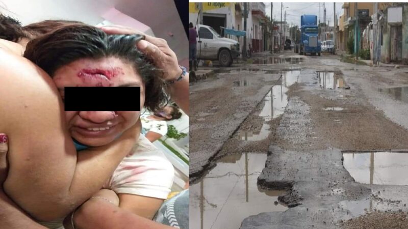 Ciclista se va dentro de un bache y queda su cabeza como alcancía en Progreso