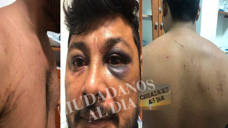 Lo cuelgan como piñata, lo torturan y amenazan de muerte por la policía de Chicxulub Pueblo