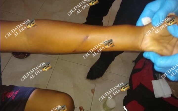 Un menor motuleño resultó herido de un escopetazo, se desconoce quien le disparo.