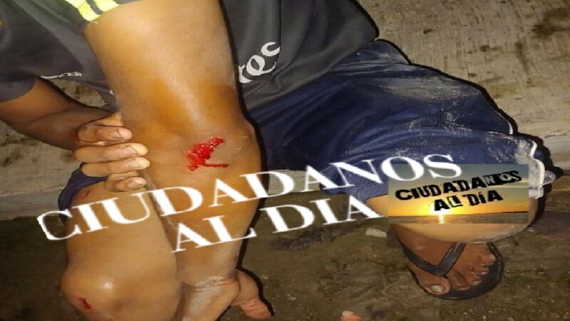 Mujer distraída lesionó a un menor con la portezuela de un automóvil