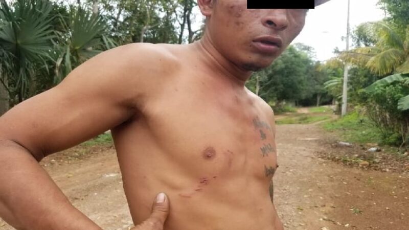 Dice que fue golpeado por policías de Tzucacab, el jefe policiaco dice que es mentira y que se lastimó solo.