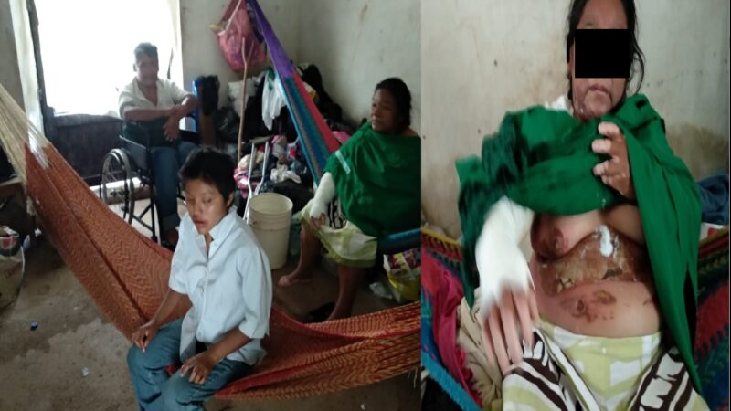 Familia discapacitada clama ayuda ante el abandono de la comuna de Seyé