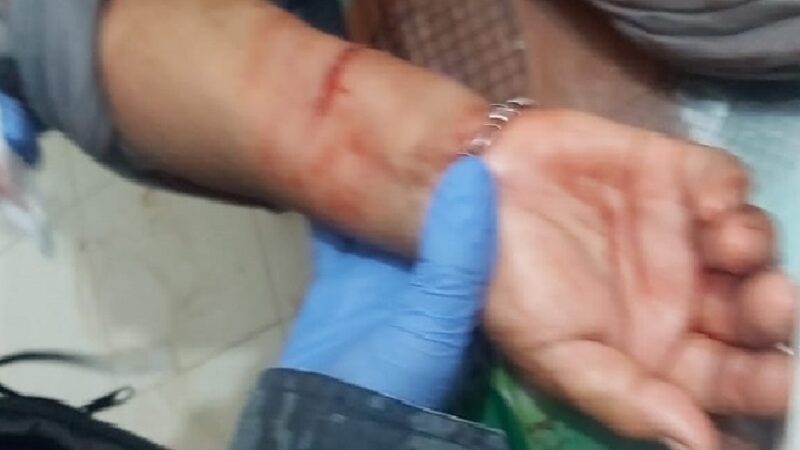 Una Mujer se cortó las venas en Umán, intento suicidarse