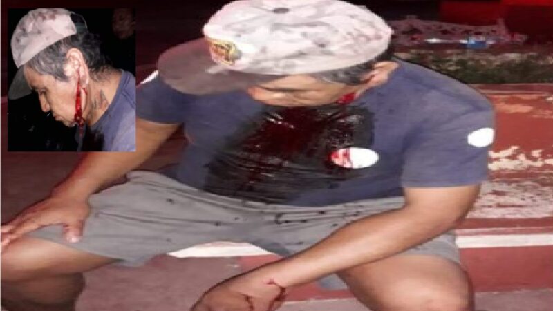 Pleito y machetazos entre dos tabasqueños, uno resulto lesionado en Buctzotz