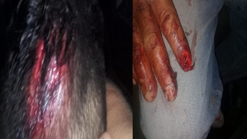 Motociclista ebrio derrapa y se lesiona, la policía de Baca le negó atención