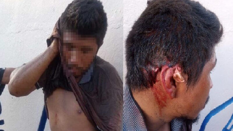 Jardinero cae de una escalera y se rebana un pedazo de su oreja en Tizimín