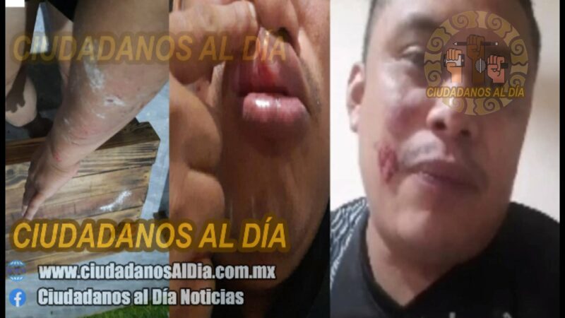 A golpes le recuerdan que no debe acercarse a su esposa en Oxkutzcab