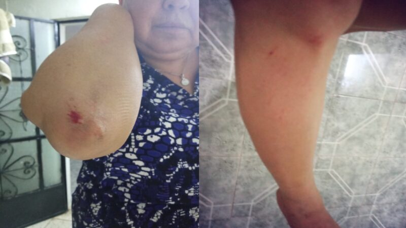 Menor distraída, atropella y lesiona a una maestra que caminaba en Dzidzantún