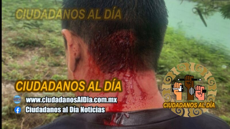 Dos jugadores agreden a un árbitro en suma, fuera de por vida del fútbol estatal