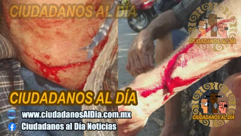 El ebrio Bartolo machetea y hiere al “Chinaco” en Buctzotz y escapa de la policía