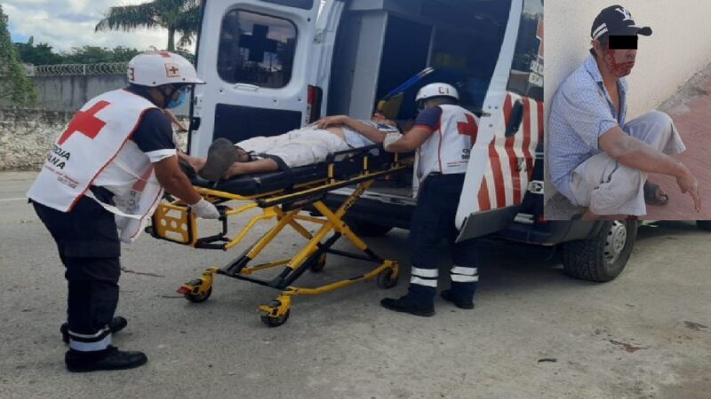 Tizimileño resbala al pasar unas boyas en su bicicleta, cae y se lesiona