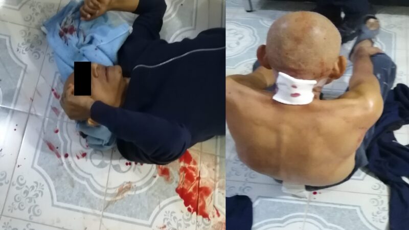 Atacan a periodista y a su esposa con un cuchillo dentro de su casa, esta hospitalizado