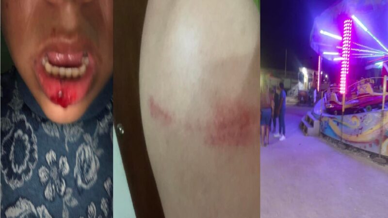 Dos lesionados les cayó un tubo metálico en la cara en el malecón de Progreso