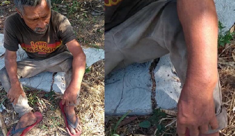 Inhumana administración de Tixkokob ante indigente con una muñeca fracturada