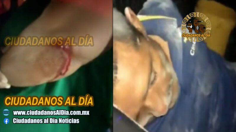 Por celos un ebrio macheteo a su mujer en Flamboyanes comisaría de Progreso