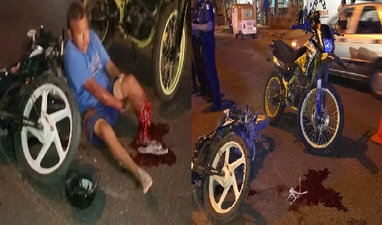Un Motociclista perdió una pantorrilla después que se voló un alto y choco contra otra moto