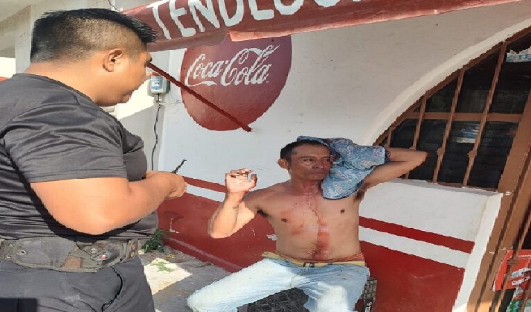 Le rompen su cabeza de una pedrada intenta atrapar a su agresor y chocó contra una camioneta
