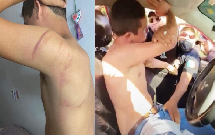 Policías confunden su auto con uno robado y lo bajaron de los testículos