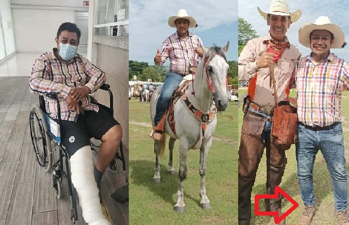 Funcionario “Poch Vaquero”  se fracturó una pierna en cabalgata en Muna