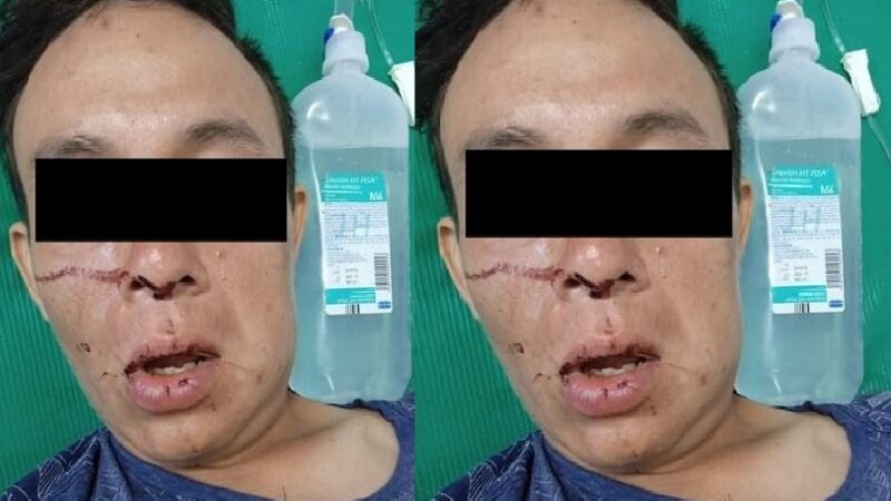 Denuncian otro abuso de policías de Tixkokob; hay un detenido hospitalizado  