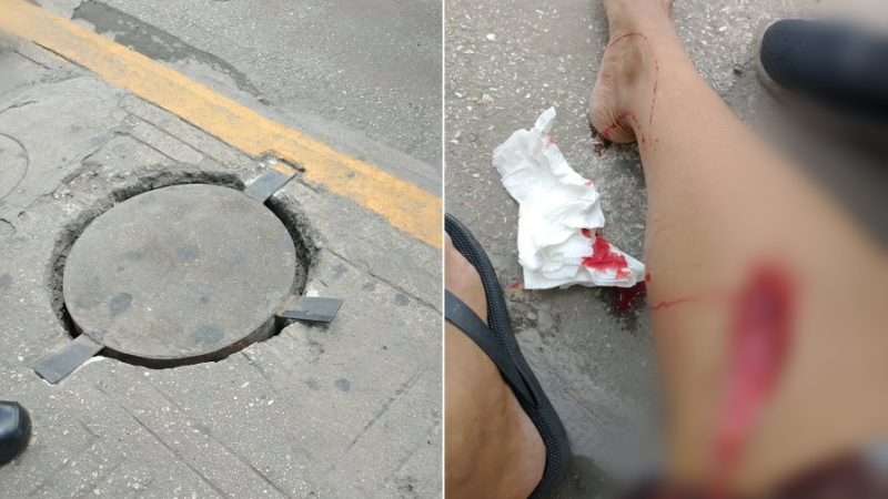 Se le corta la pierna por una tapa mal asegurada en el centro de Mérida