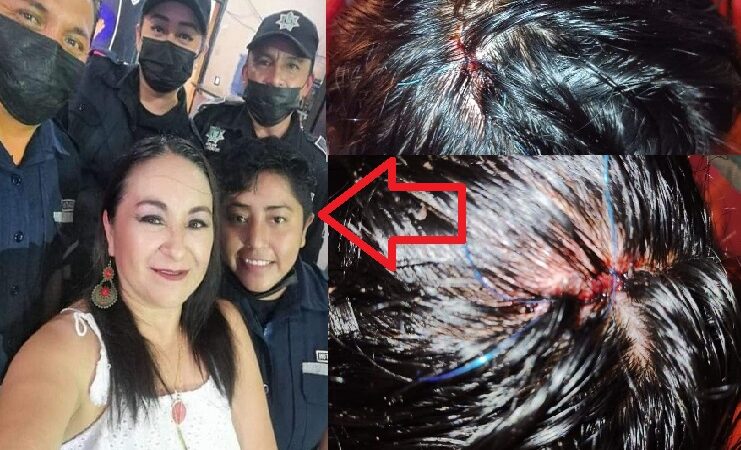 Una paramédico le rompió la cabeza a una mujer: la policía y comuna la encubrió