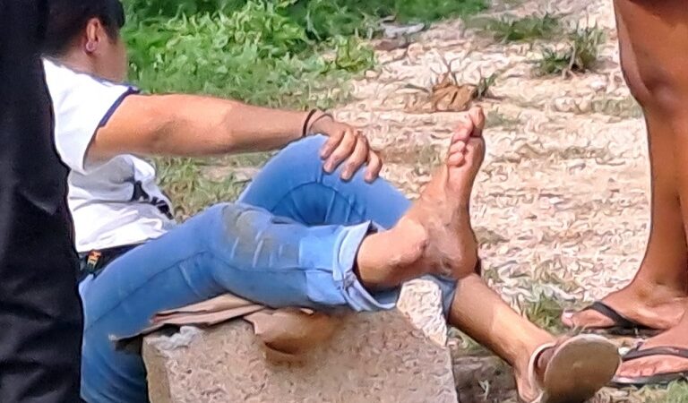 Por esquiva una camioneta una adolescente derrapó en su moto y se fracturó un pie