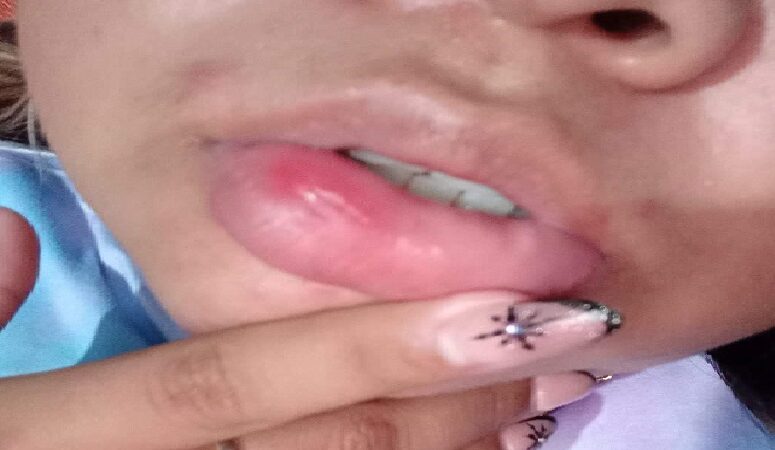 Violento sujeto golpeó en el centro de Motul a una mujer para robarle una motocicleta