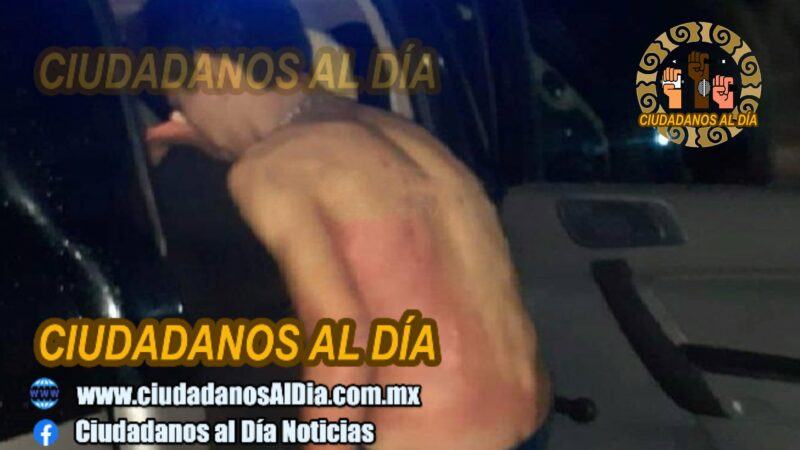 Adolescente se quema espalda y abdomen con una olla de comida hirviendo en Popolnáh   