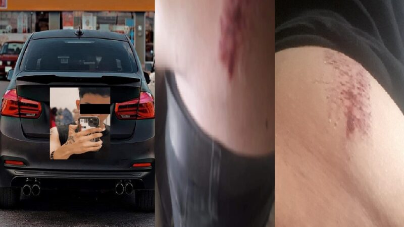 Violento joven golpeó a un periodista en Dzilam González, porque no le vendió un saxofón