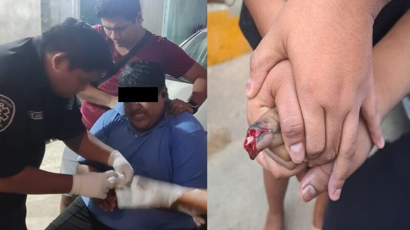 Por jugarle al mecánico un menor se vuela un dedo con la cadena de su moto en Kanasín