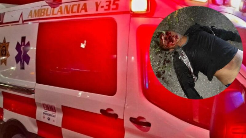 Ubio motociclista iba a visitar a su novia en Samahil y terminó lesionado en una clínica