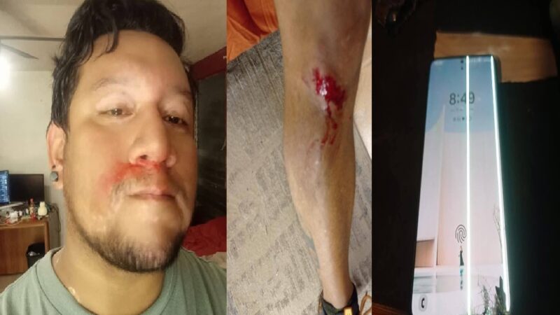 Un joven lo golpean y asaltan por tres encapuchados mientras hacía ejercicio en la avenida 27 de Chenkú