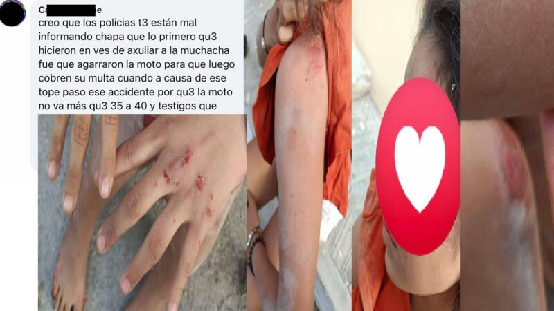 Dos menores derrapan y lesionan en el enorme tope que mando a poner el alcalde Ponto en Dzilam de Bravo