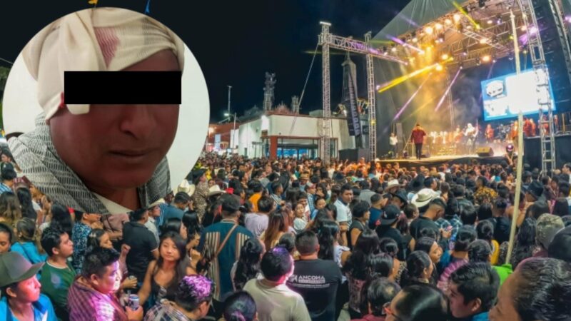 Por coqueto le muerden y arrancan parte de la piel de la cara durante el carnaval en Motul