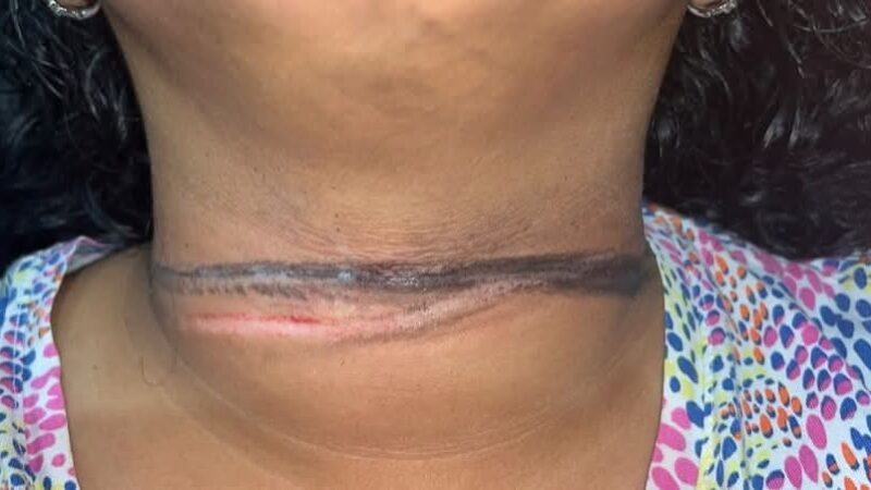 Como gallina por poco la degüellan con un cable de internet en ciudad Caucel