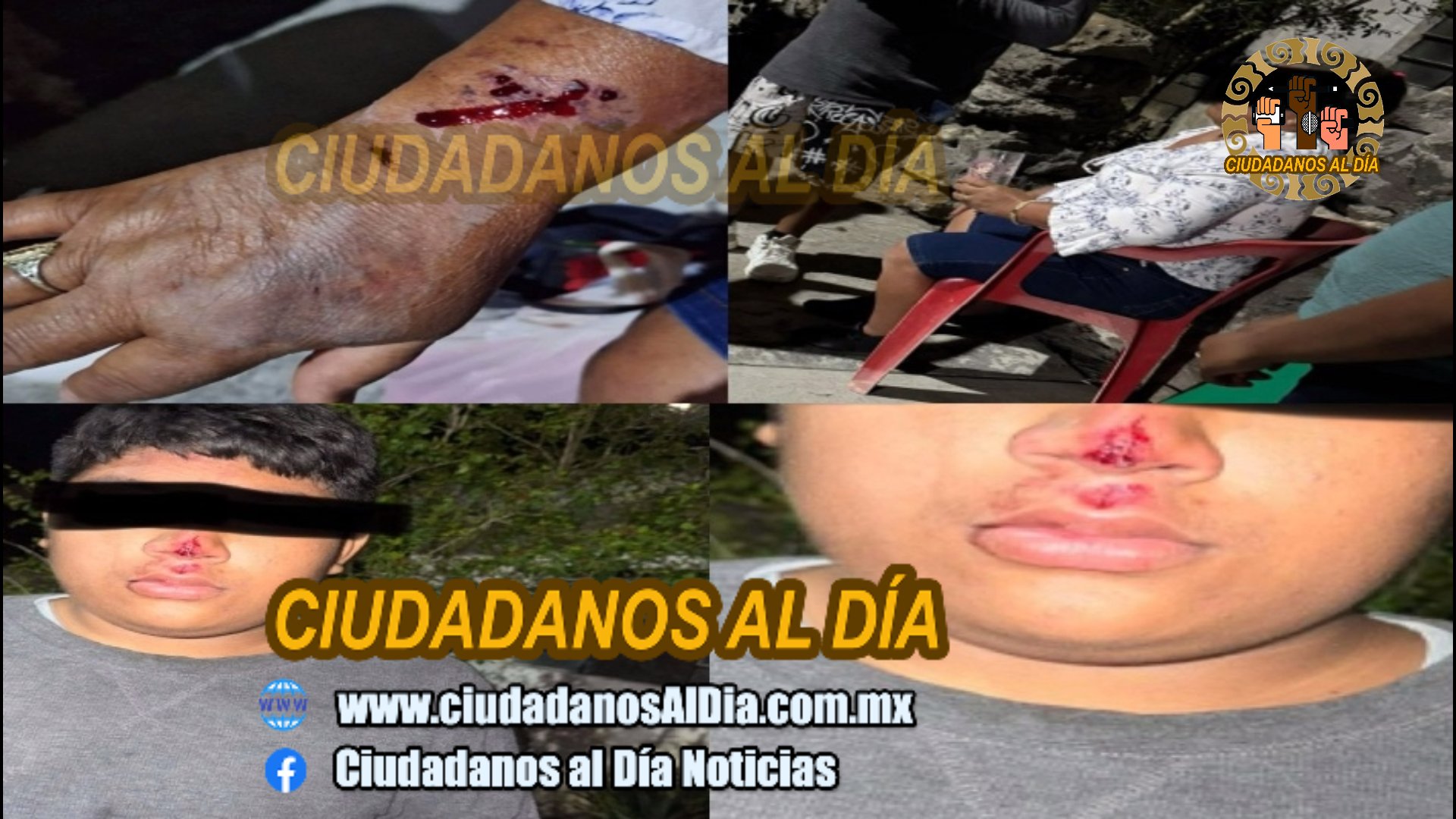 Un mototaxi cae en un enorme bache y vuelca en Dzidzantún: Hay tres lesionados