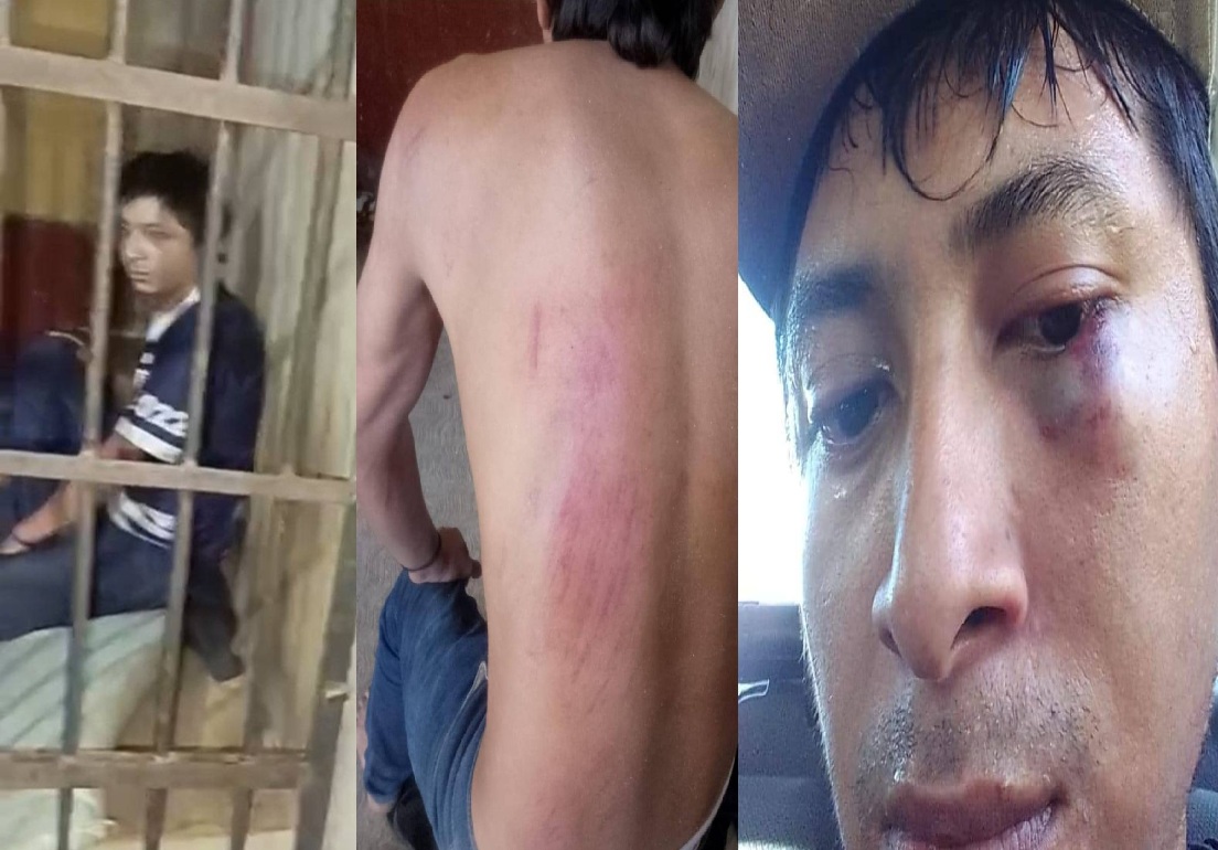Violento policía de Seyé golpea al ex marido de su pareja: Pensó que lo estaban “Tarreando”