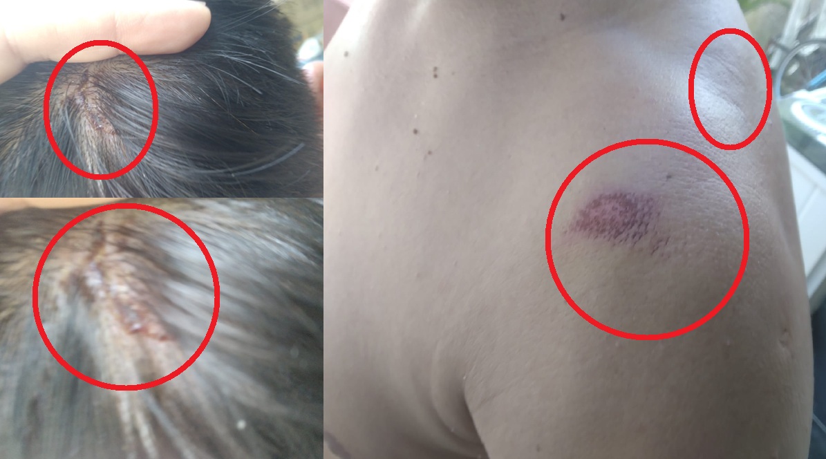 Violenta policía de Dzidzantún golpea, lesiona aun detenido y desaparece un automóvil