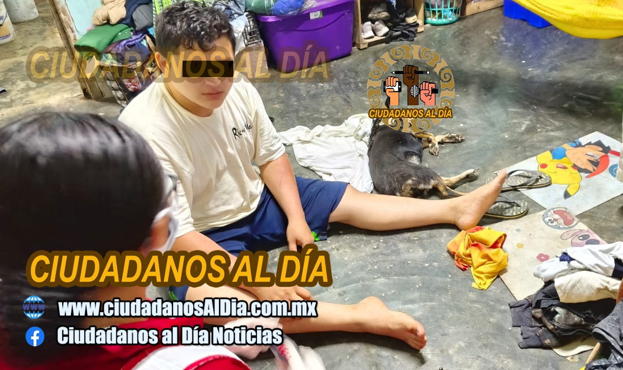 Un perro Pitbull entra a una casa, lesiona a una perrita y a un joven en Progreso