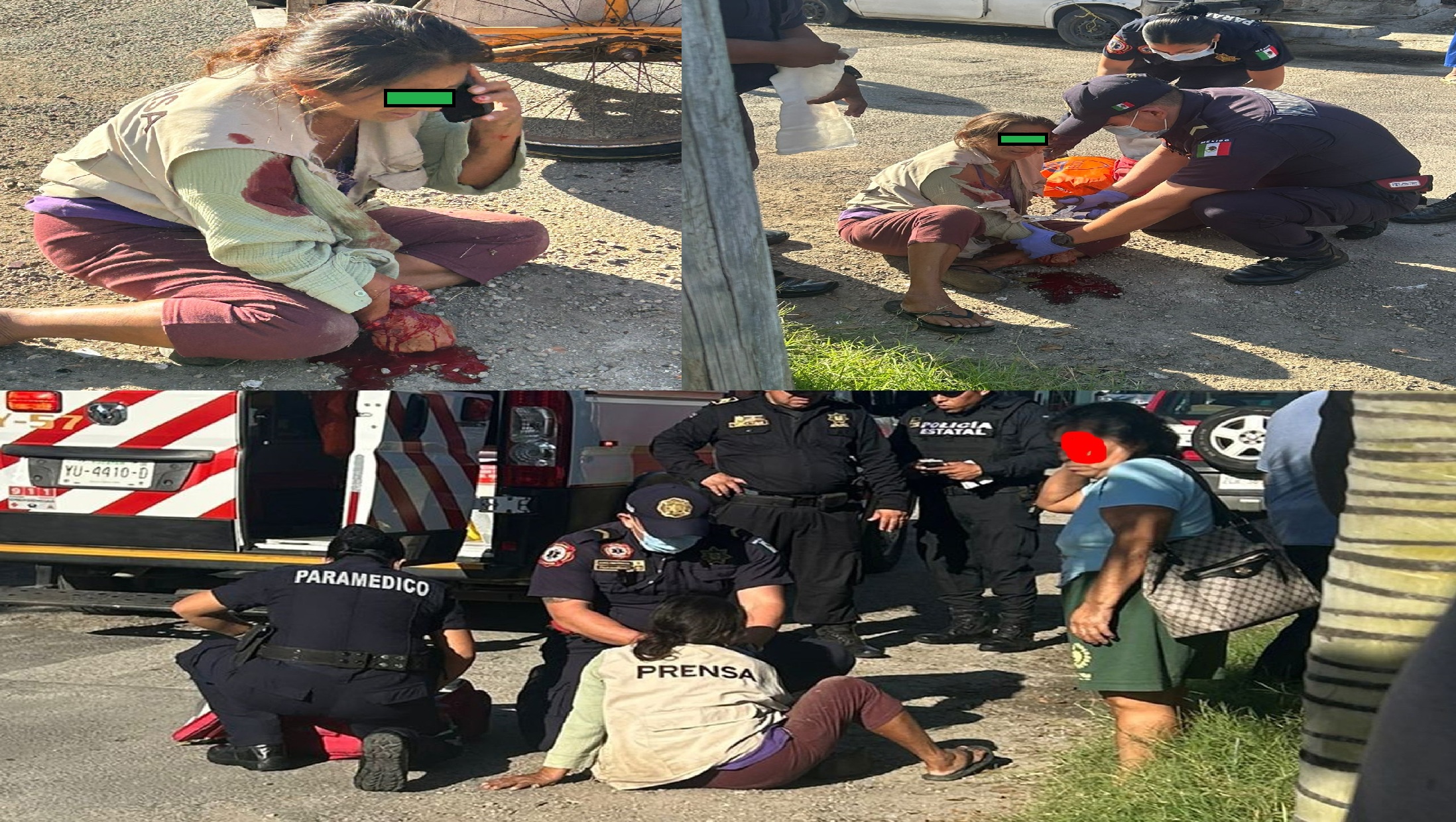 Pitbull ataca y casi le arranca la mano a una abuelita repartidora de periódicos en la colonia Vergel II