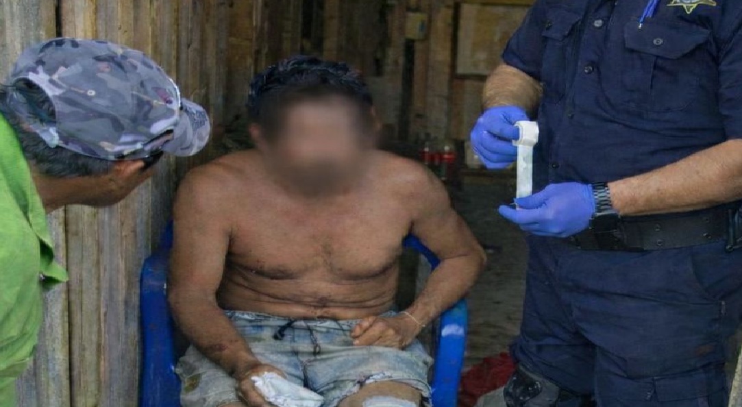 Pleito familiar: Una mujer apuñala a su esposo y se da a la fuga en Temax