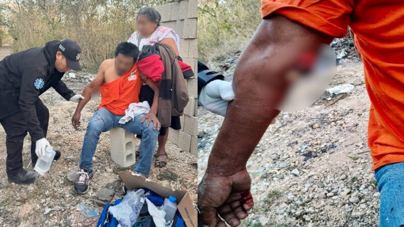 Joseé criaba a sus pájaros, resbala de una banca y se fractura el brazo en Kanasín