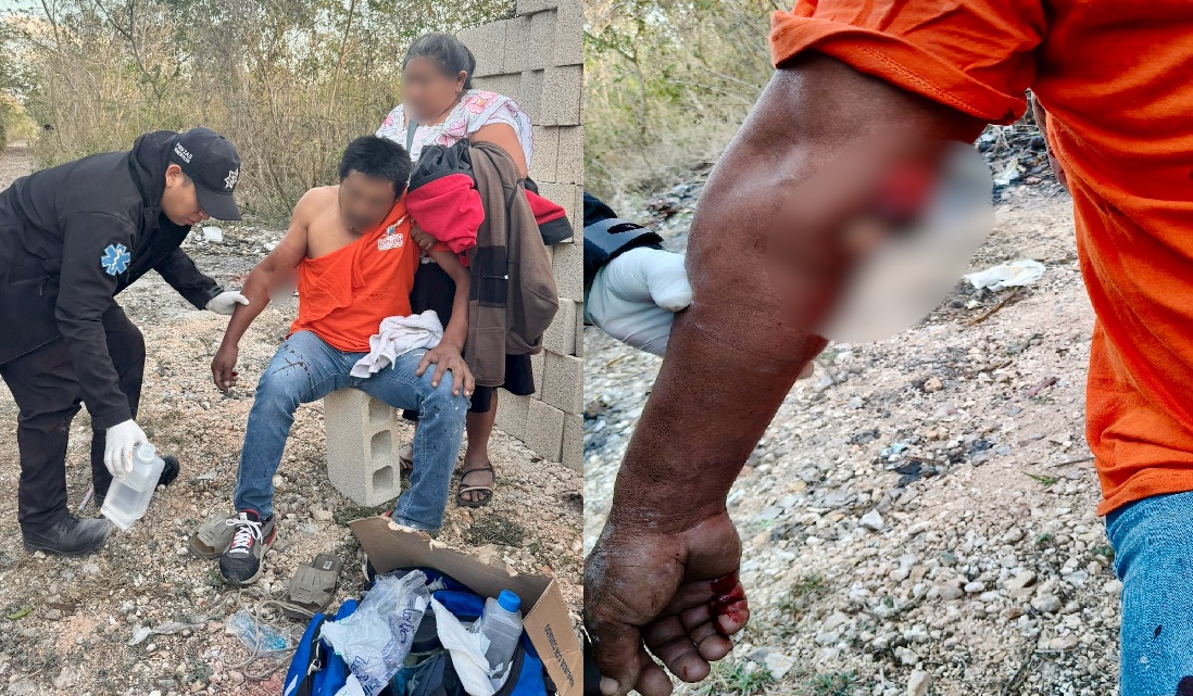 Joseé criaba a sus pájaros, resbala de una banca y se fractura el brazo en Kanasín