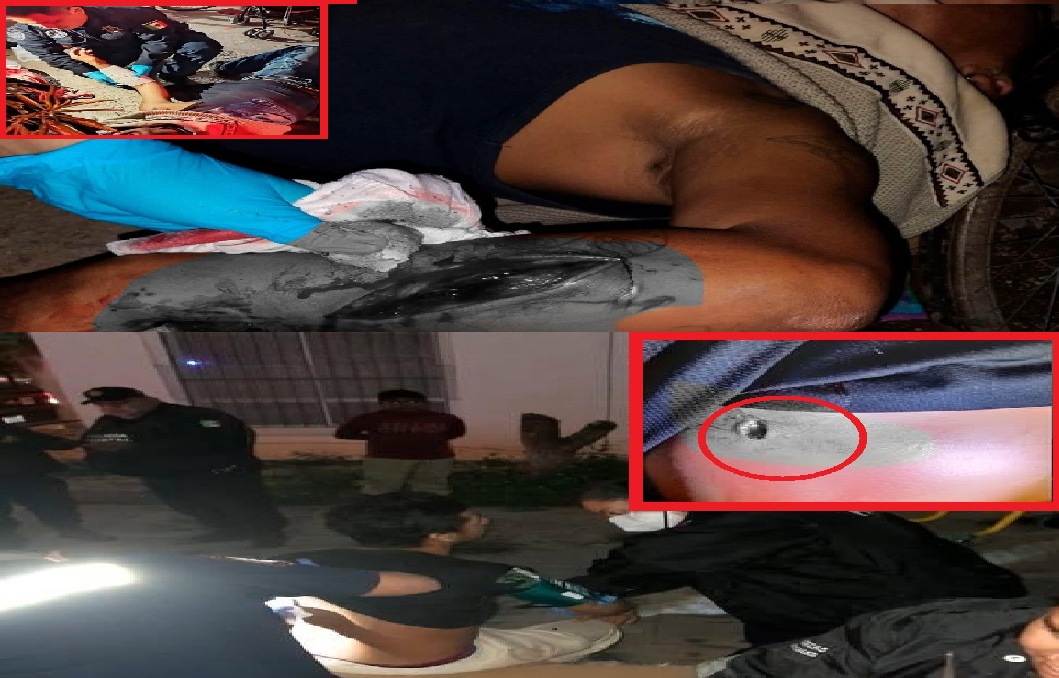 Pandilleros apuñalan a un joven en Cielo Alto, y machetean a otro en las Palmas De San Pedro, Kanasín